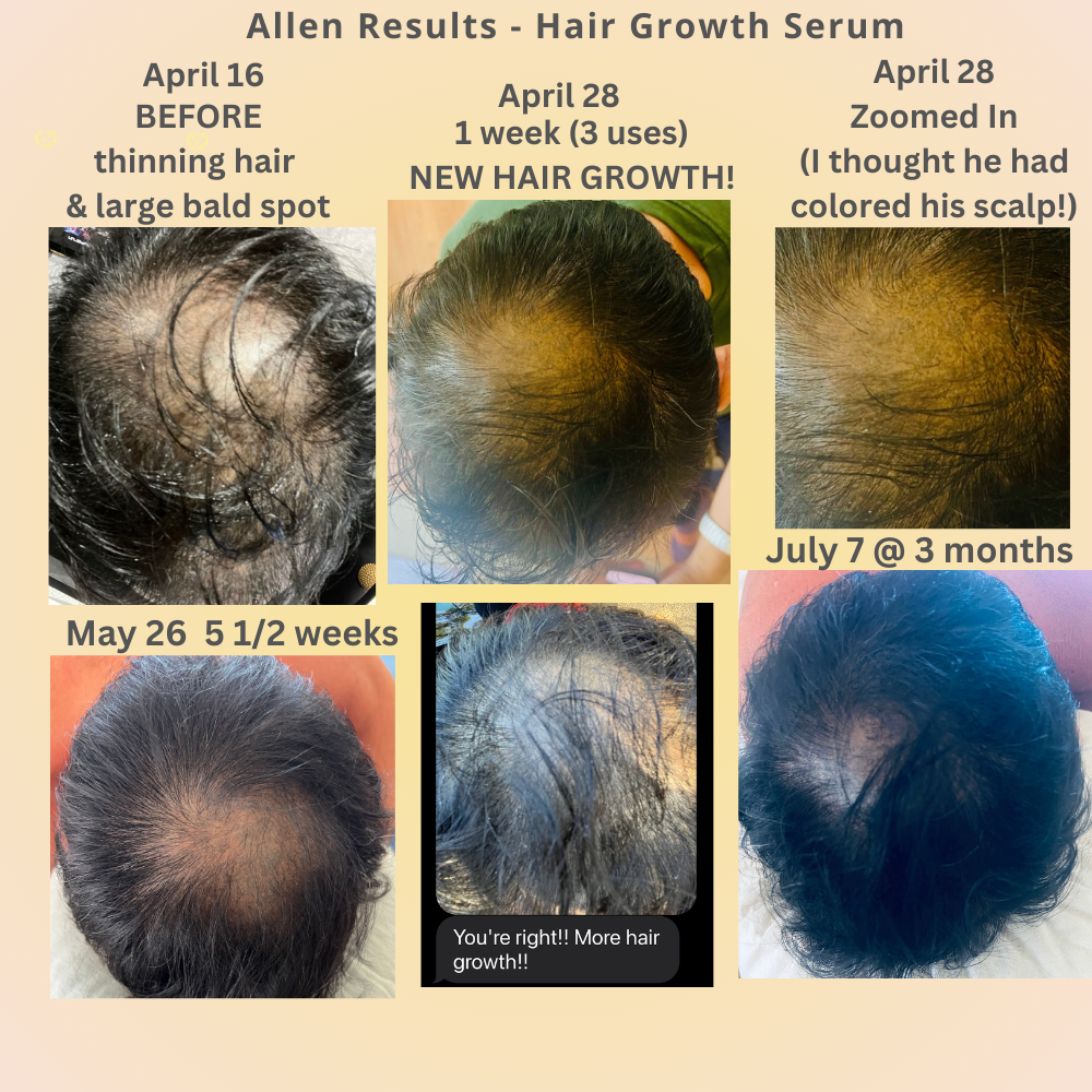 Hair Growth Serum