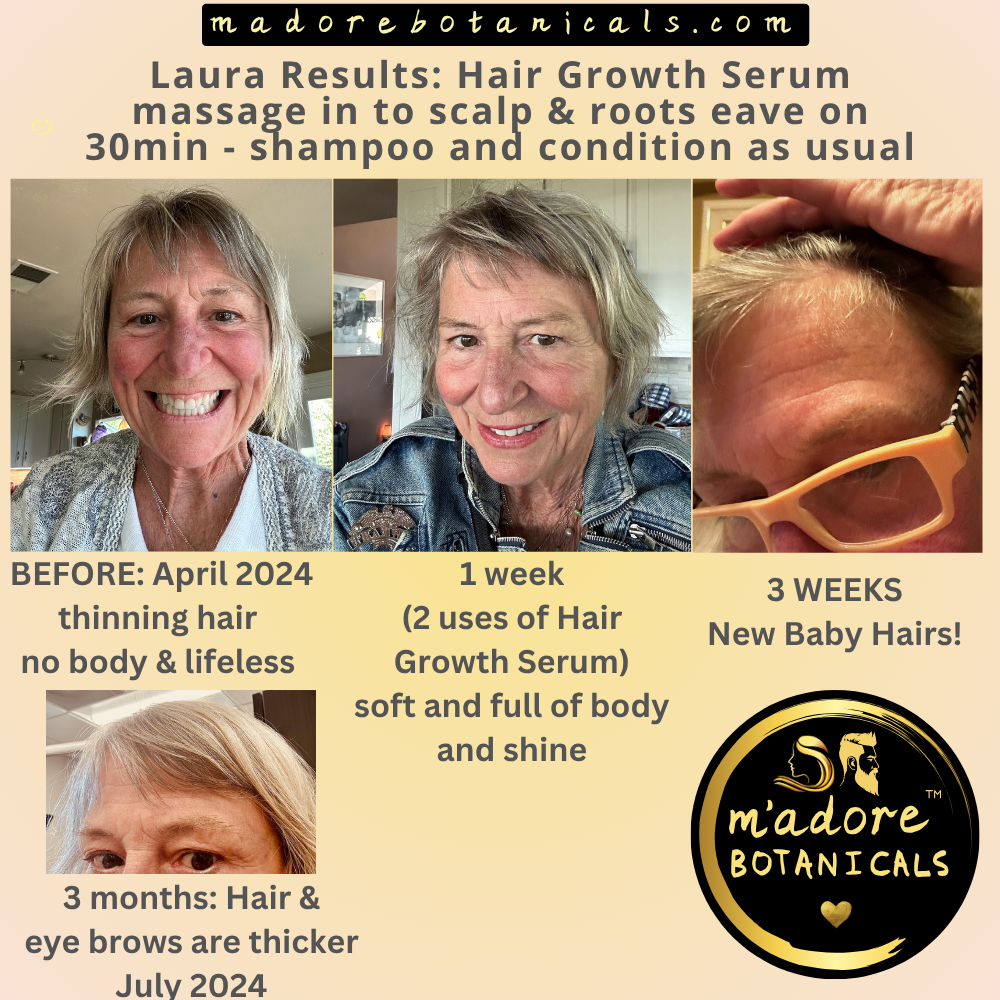 Hair Growth Serum